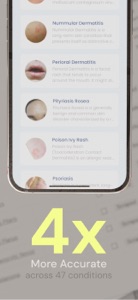 Rash ID - Skin Rash Identifier screenshot #4 for iPhone