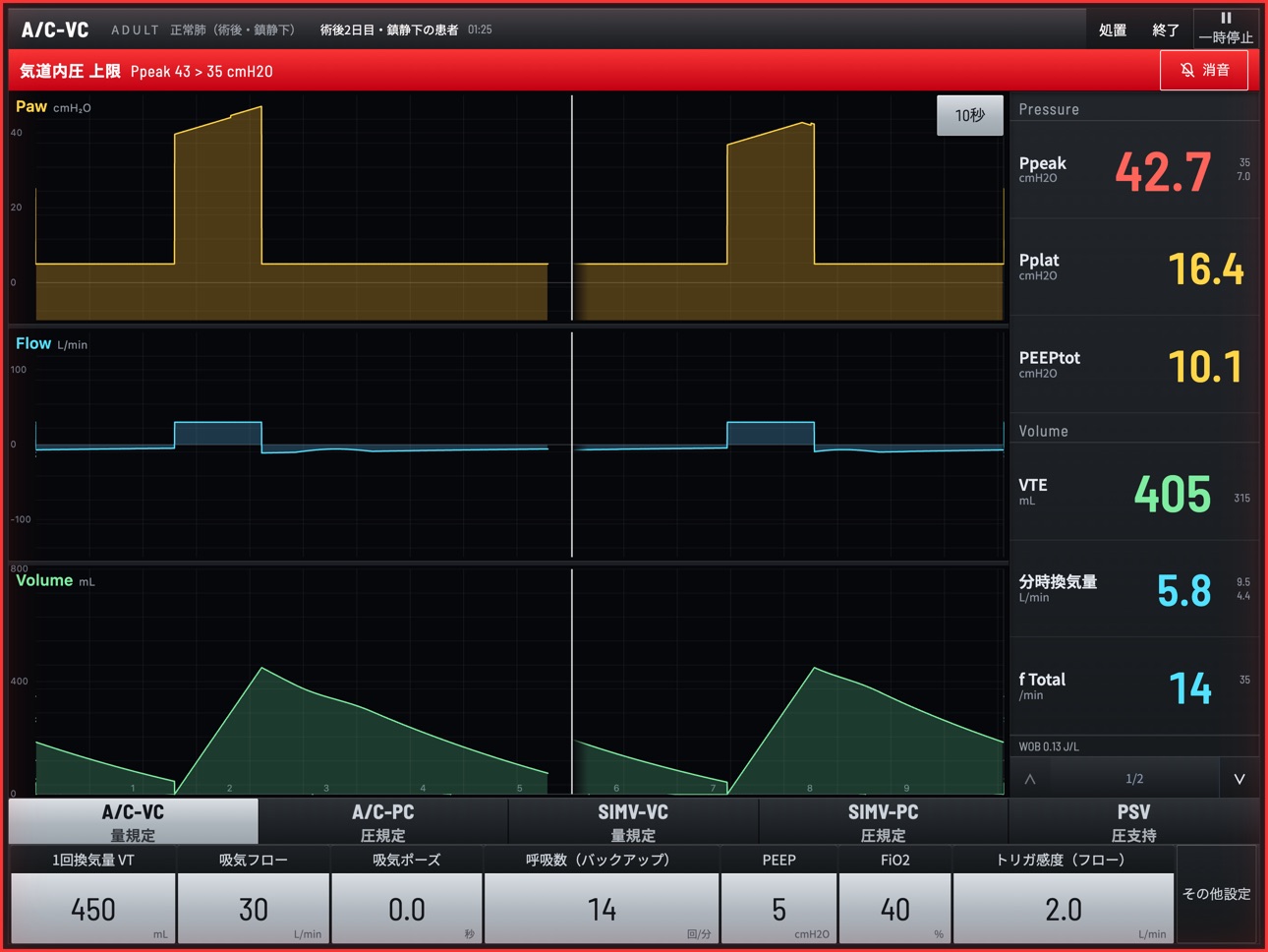 Screenshot 2 of Vent Sim - Ventilator Training
