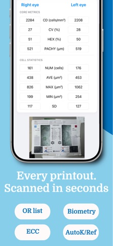 PhacoTrack screenshot