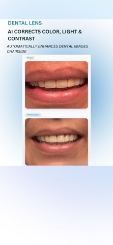 Dentallens screenshot
