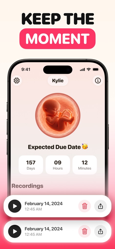 Baby Heartbeat Monitor - Molio - Discover how the app preserves precious moments, featuring an intuitive due date countdown and accessible recording playback options.