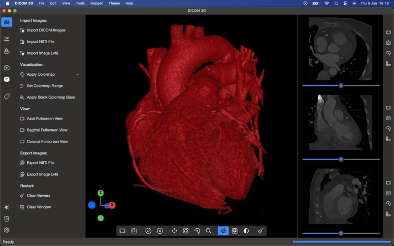 DICOM 3D Screenshot