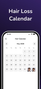 AI Hairloss Analysis - Tracker screenshot