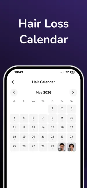 AI Hairloss Analysis - Tracker screenshot 4