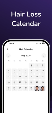 AI Hairloss Analysis - Tracker screenshot