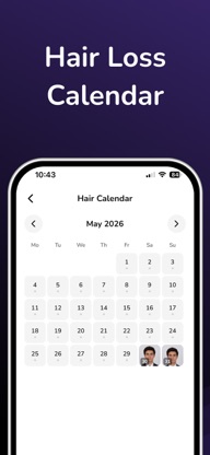 AI Hairloss Analysis - Tracker screenshot 4