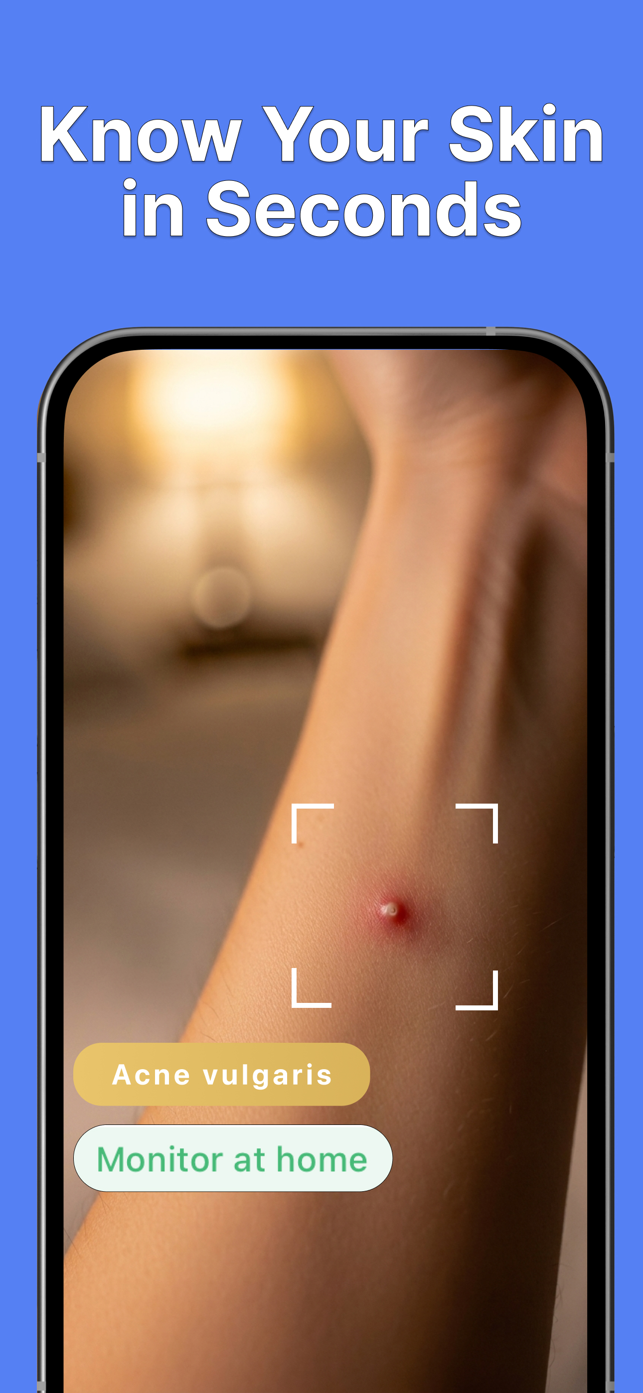 Skin Care Scanner: Skin Lens