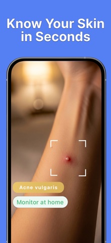 皮肤扫描仪 AI: Skin Lens screenshot