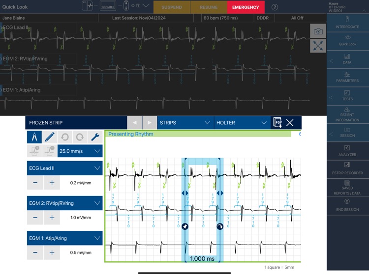 CareLink SmartSync™ LATAMM