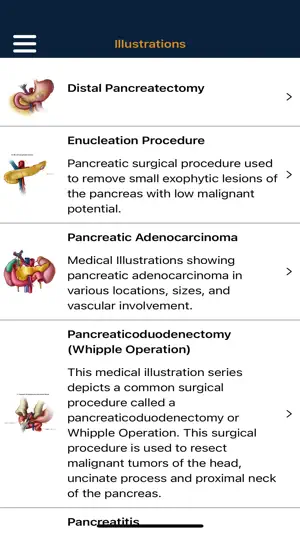 CTisus Pancreas Compendium screenshot 3
