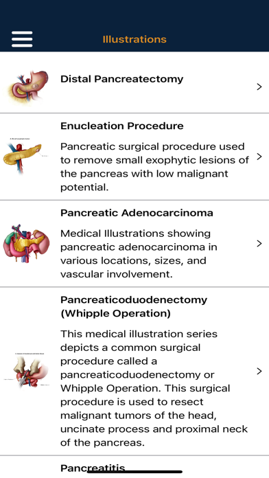 Screenshot #3 pour CTisus Pancreas Compendium