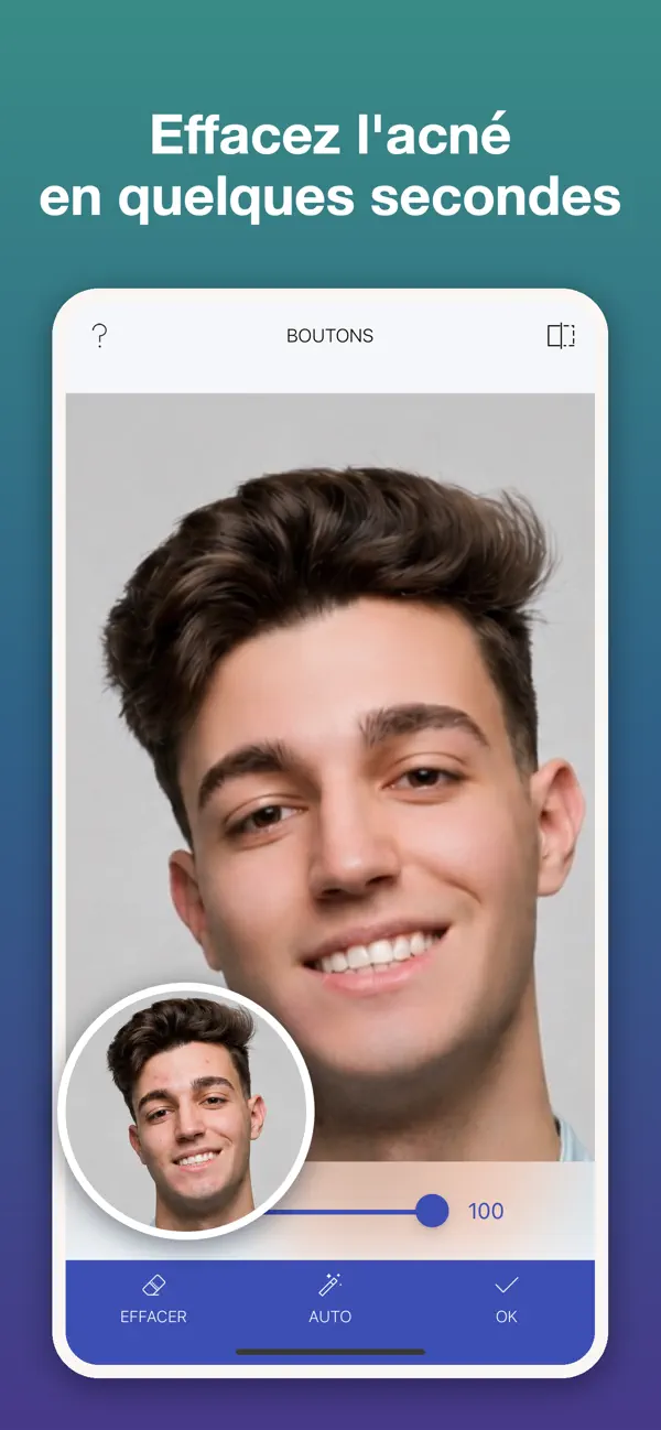Screenshot #2 pour Clear Skin: AI Face Editor