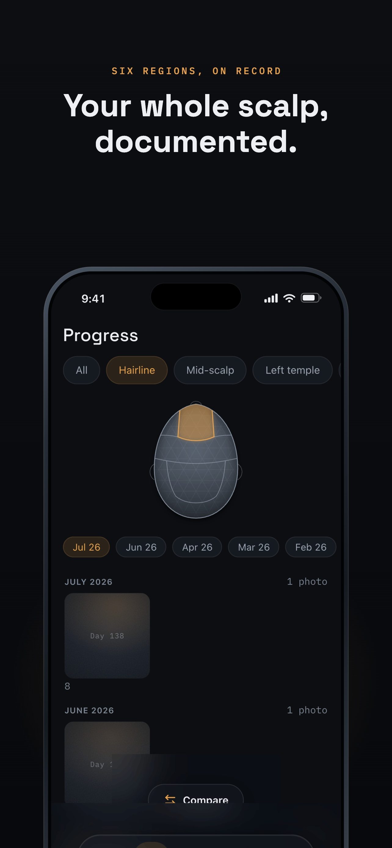 Norwood: Hair Loss Tracker screenshot 5