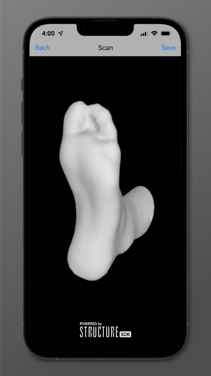 MediScan Custom Orthotics