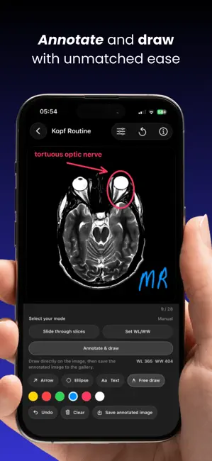 DICOM Viewer : MRI CT XRAY & + iPhone screenshot 2