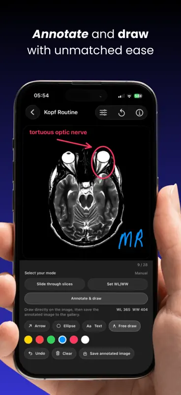 DICOM VIEWER MRT CT Röntgen screenshot 2 of 8