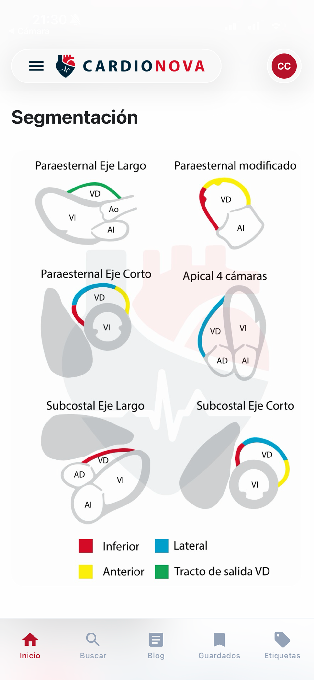 CardioNova screenshot 3