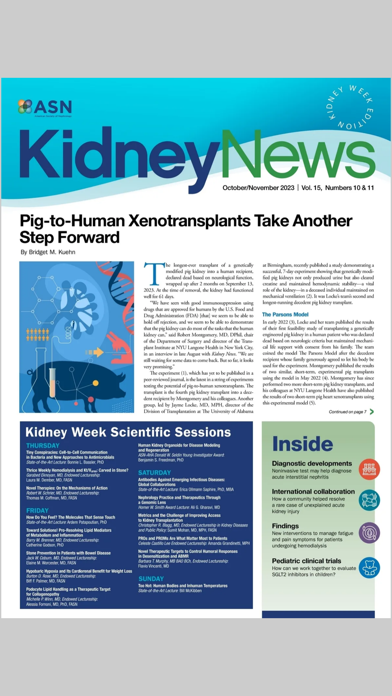 ASN Kidney News Screenshot