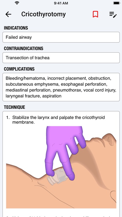 palmEM AI: EM Quick Reference screenshot-7