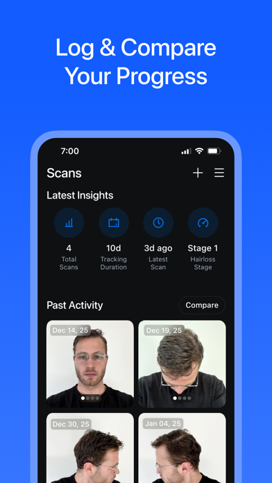 Hairloss AI: Scan Hair Health Screenshot