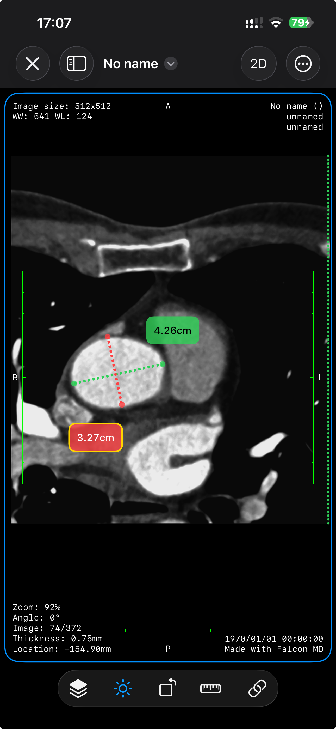 Falcon MD - DICOM Viewer screenshot 7