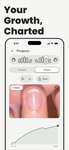 Stop Nail Biting: Nonyxa Screenshot 6 of 9