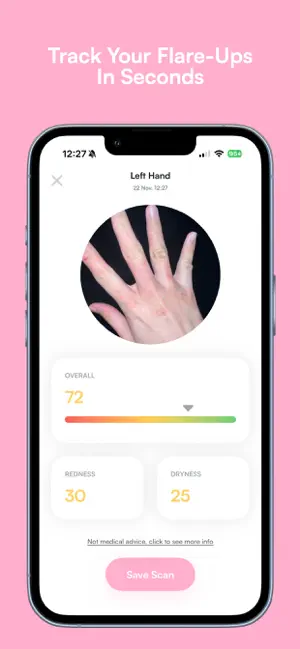 Alara - AI Eczema Tracker screenshot 2