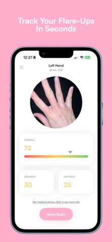 Alara - AI Eczema Tracker Screenshot 2 of 5