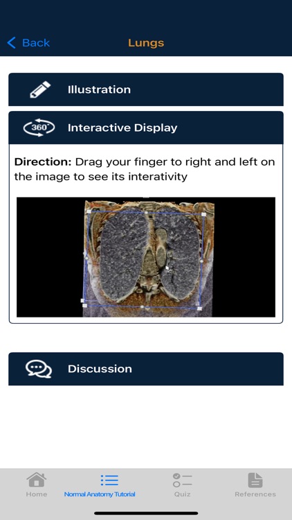 CTisus Chest Atlas 3D CRT screenshot-3