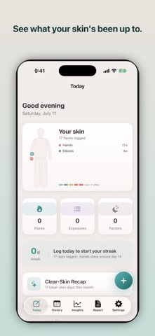 Skinote: Eczema Tracker & Log Screenshot 1 of 6