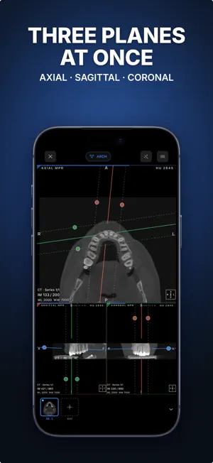 Ossidex: DICOM Viewer CT & MRI screenshot 2