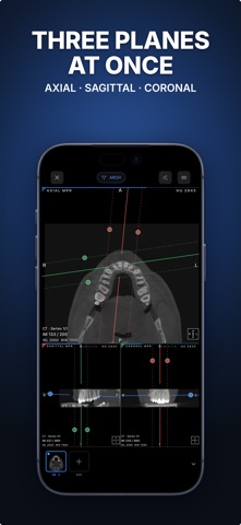 Ossidex: DICOM Viewer CT & MRI Screenshot 2 of 6