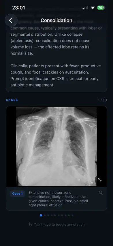 iXRchest screenshot 3