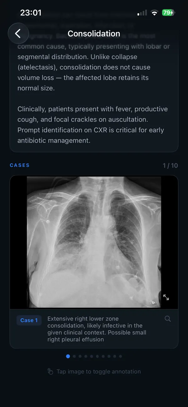 Screenshot #3 pour iXRchest