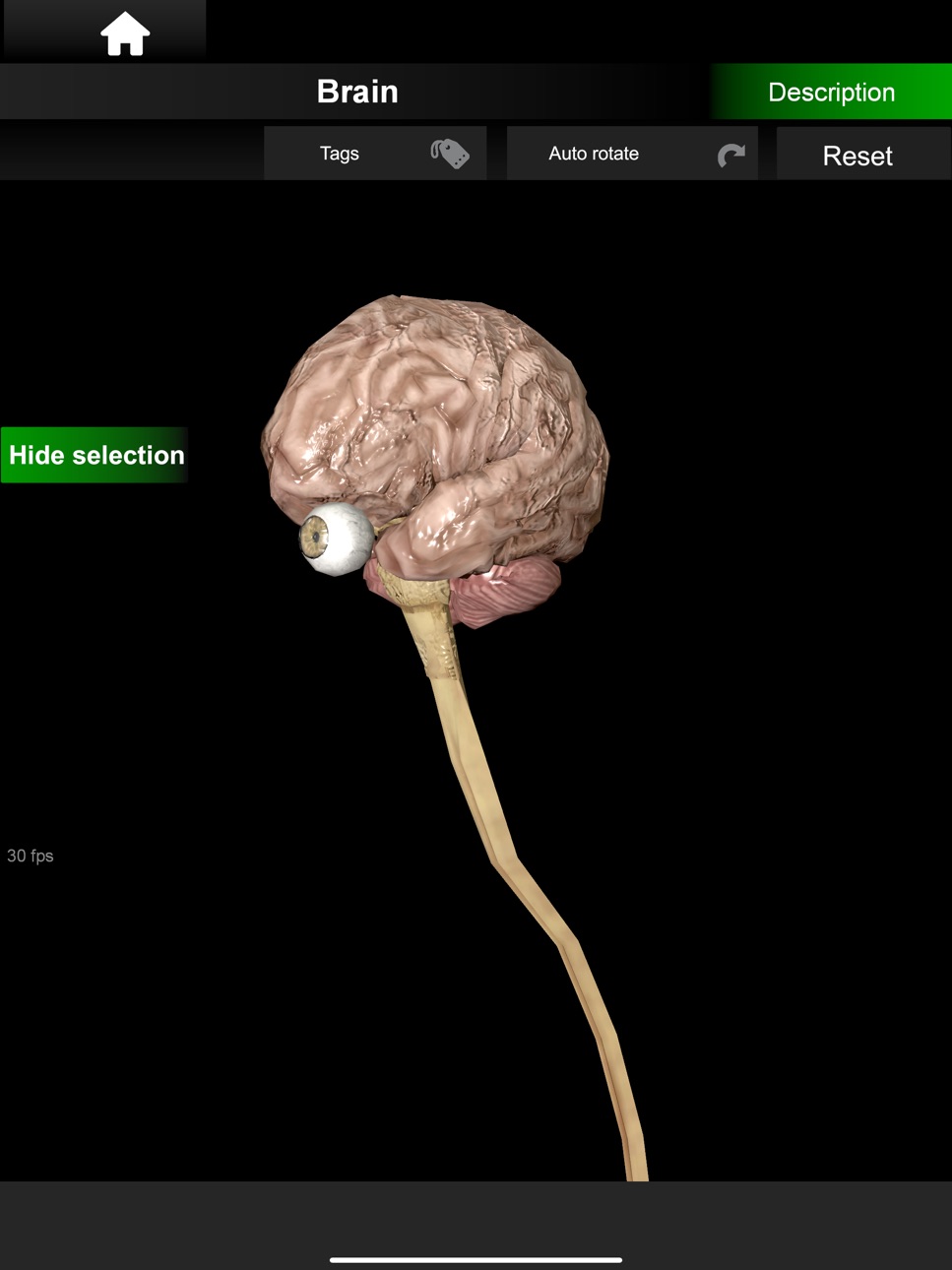 iPad screenshot