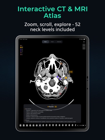 Lymph Atlas iPad screenshot