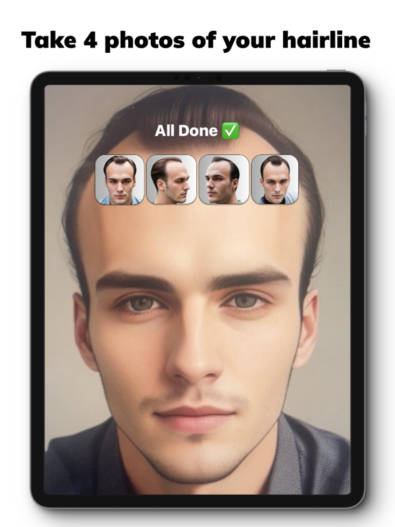 Hairline AI - Receding?