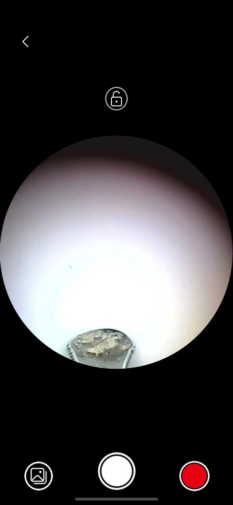 Visual ear spoon - L'outil affiche une image en temps réel et de haute qualité du conduit auditif, permettant une exploration détaillée et des captures instantanées via les icônes dédiées à la photo et à la vidéo.