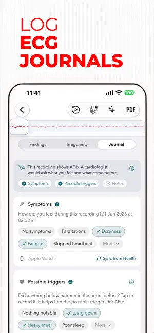 ECG+ | Your Watch ECG Reader screenshot 4