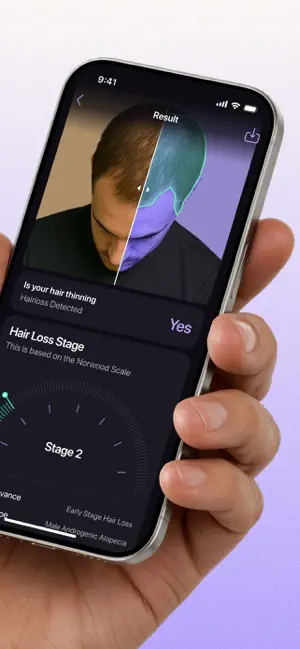 HairLoss AI: Beat Balding screenshot 2