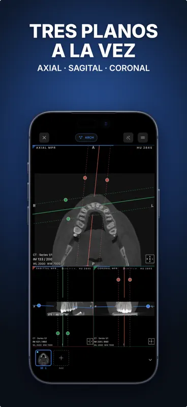 Ossidex: Visor DICOM, TAC, RM screenshot 2 of 6