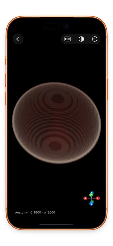 Lumen — DICOM viewer screenshot 4