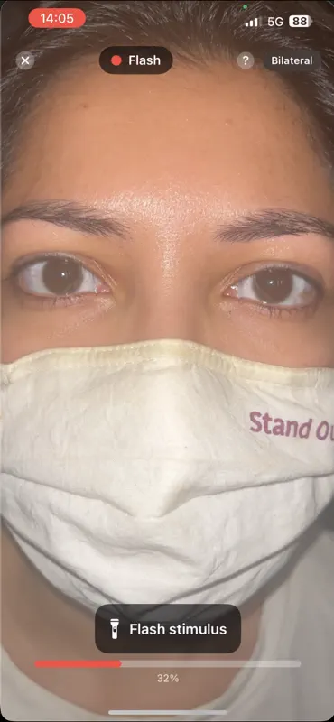 PupiLUX:Pupillary Light Reflex screenshot 2 of 10