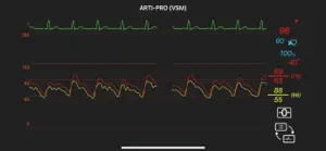 ARTI-PRO VSM screenshot 2