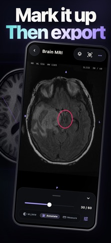 DICOM Viewer: MRI CT Studio 스크린샷 2