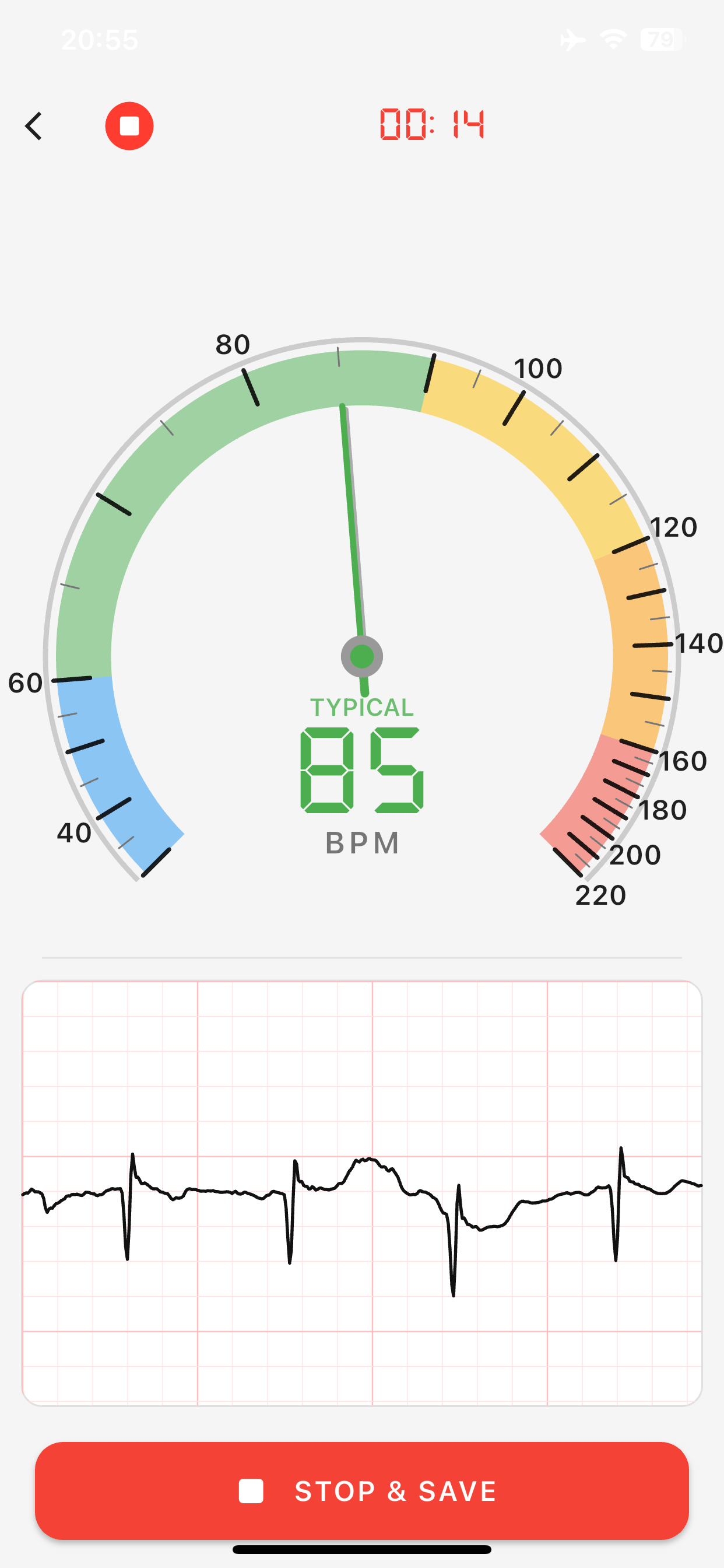 ECG Suite