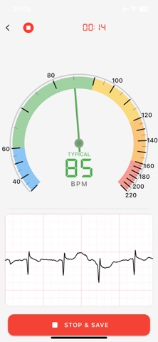 ECG Suite screenshot
