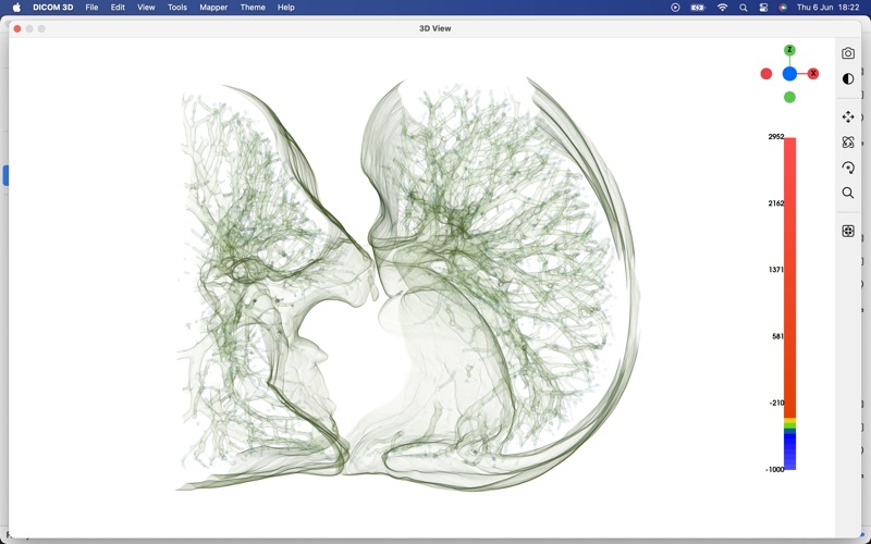 DICOM 3D Screenshot