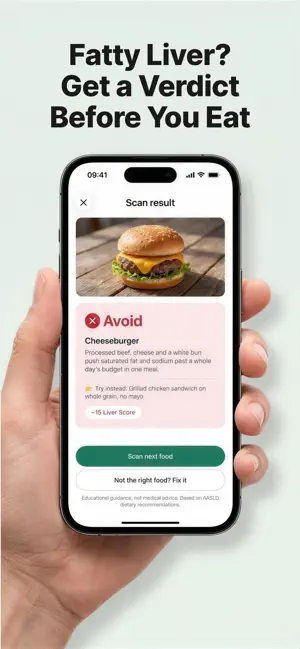 Fatty Liver Diet: Food Checker screenshot 1