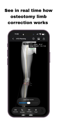 OsteoPlan screenshot